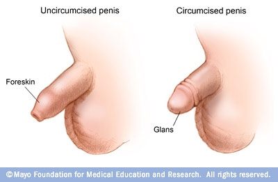 Mayo Clinic's pictures of before and after