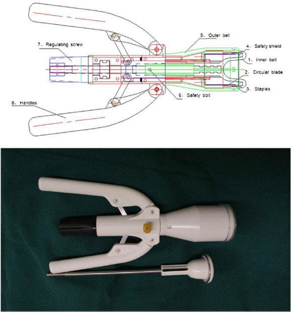 methods-circular-stapler-x-section