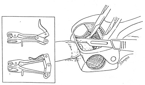 Sheldon Clamp