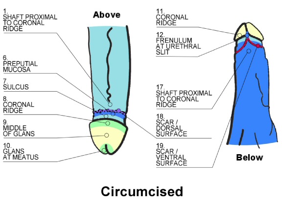 Different styles in penis circumcision - XXX Image styles circumcision penis Different in