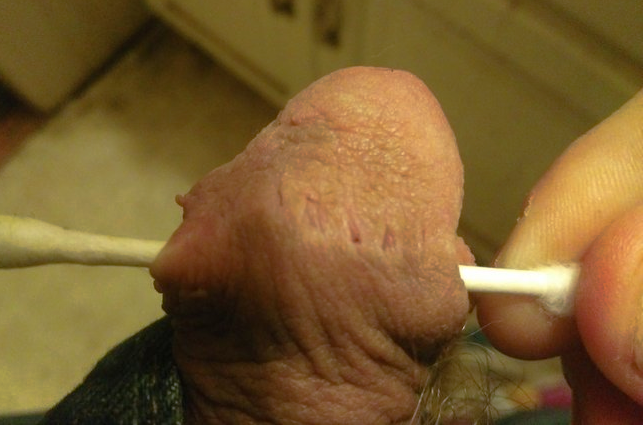 big skinbride with cotton bud