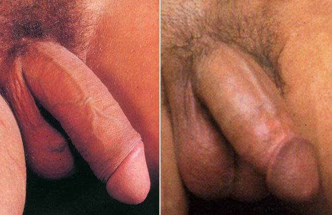 Non Circumcised Dick 80