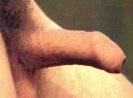 Intact penis erect, foreskin unretracted 2