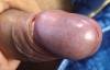 Intact penis with glossy purple glans